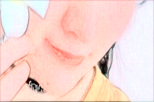 金华市中医院光子嫩肤多少费用？医生排名