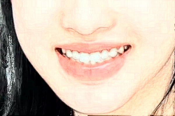 大连新华医院口腔科全瓷冠做的怎么样_哪位医生做得好