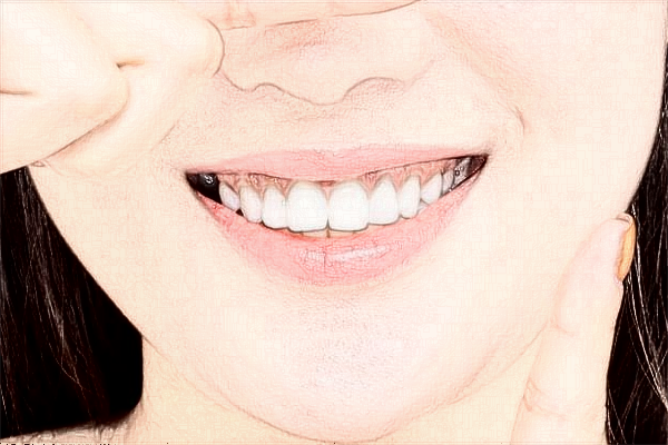 中山大学附属口腔医院正畸医生好吗?2024收费价格