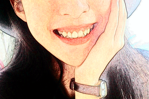 2024安徽省立医院牙齿树脂修补价格多少?贵不贵