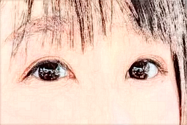 2024江苏大学附属医院割双眼皮怎么样_医生排名