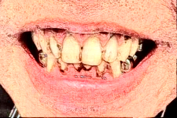 南京中大医院口腔科牙颌畸形矫正做的怎么样_谁做的比较好