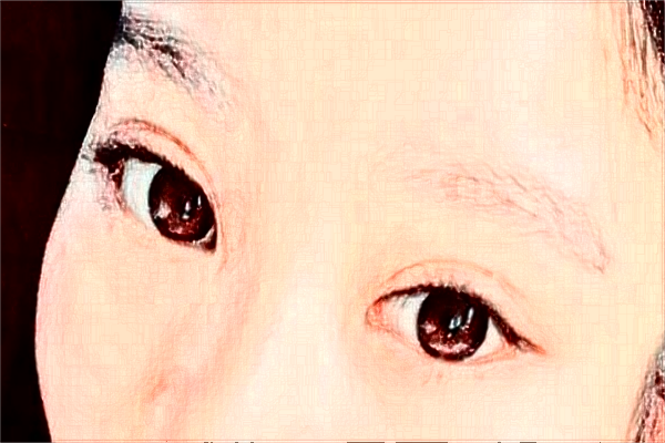 河北省人民医院光子嫩肤M22费用多少_医生名单