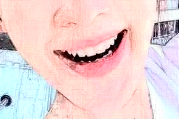 苏州大学附属儿童医院口腔科微创拔牙价格表(价目表)怎么样