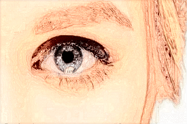 2024南宁303医院近视矫正价格?近视矫正手术副作用