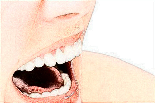 2024苏州烤瓷牙比较好的医院?排行前三医院