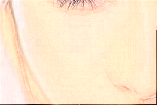 2024青岛海慈医院光子嫩肤报价?光子嫩肤有副作用和危险吗