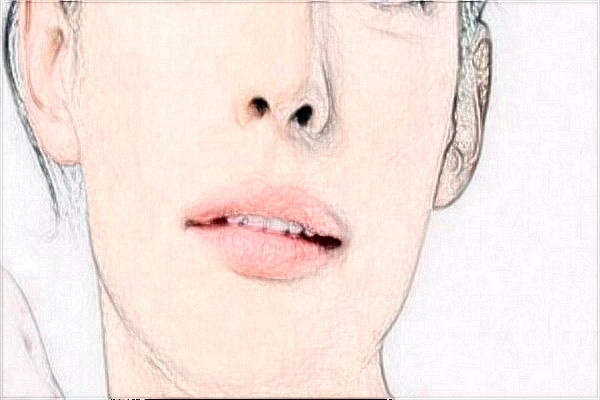 2024天津医院光子嫩肤做的好吗?整形日记分享