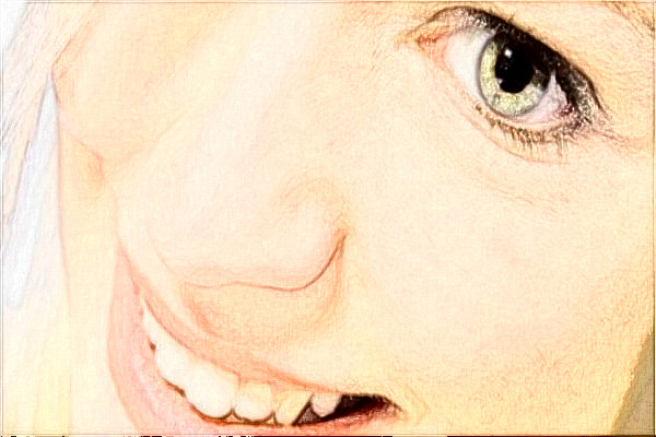 2024天津医院光子嫩肤做的好吗?整形日记分享