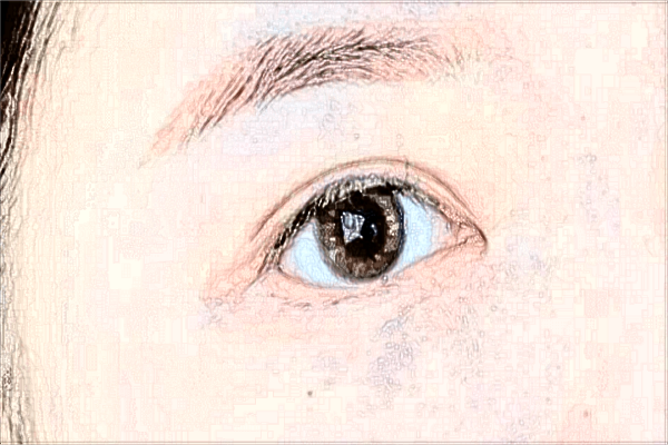 贵阳市第—人民医院近视眼手术好吗?2024近视眼手术多少钱