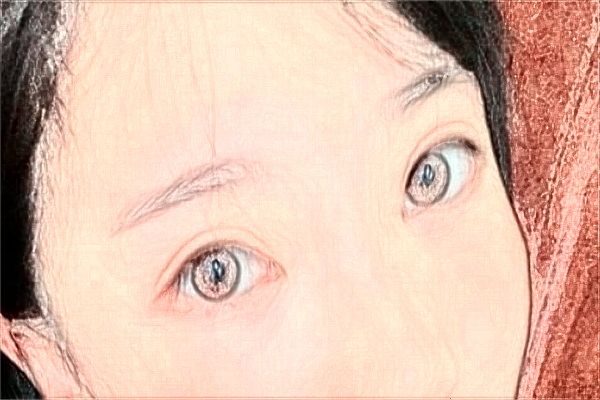 2024山西医科大学第一医院半飞秒怎么样_整形日记分享