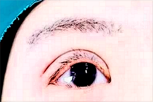 南京鼓楼医院全飞秒激光手术多少钱?医生名单推荐