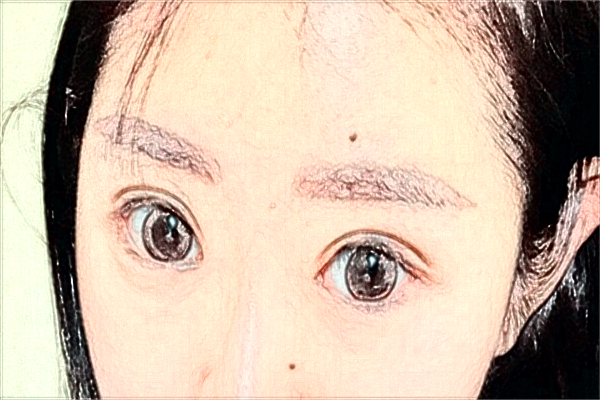 南京鼓楼医院全飞秒激光手术多少钱?医生名单推荐