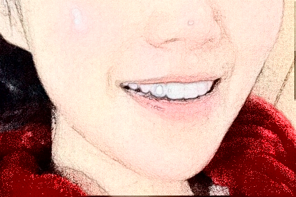 安徽省立医院根管做的怎么样【根管案例分享】