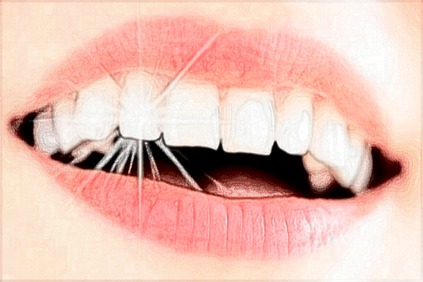 泉州180医院正畸怎么样?2024正畸牙齿的费用