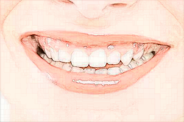 2024中山大学附属口腔医院镶牙收费标准?镶牙的材料