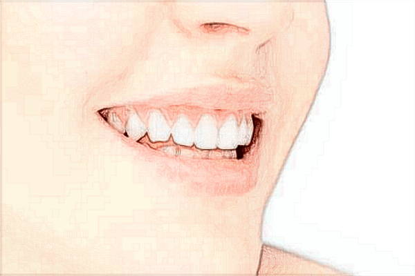 2024中山大学附属口腔医院植牙价格?植牙后注意事项