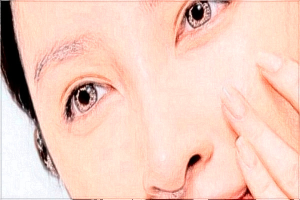 2024天津医科大学总医院可以去胎记吗？去胎记真实案例