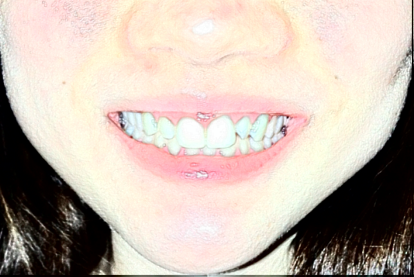 南京中大医院口腔科整牙怎么样_医生名单推荐