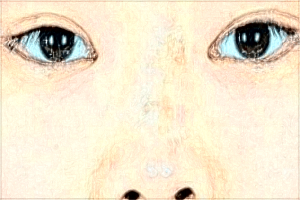 2024佛山市禅城区中心医院热玛吉价格?热玛吉是什么