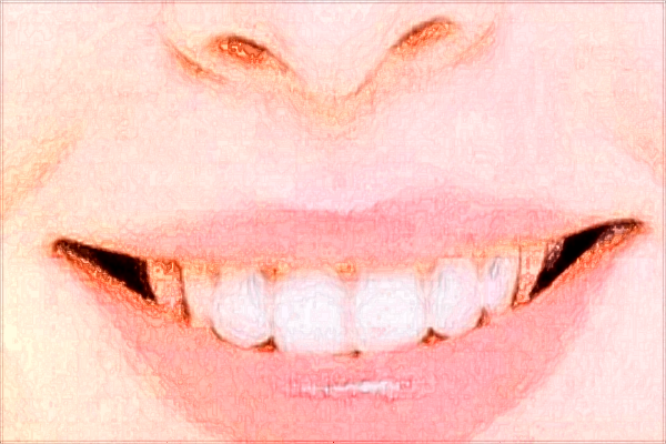 烟台毓璜顶医院拔牙可以吗?2024拔牙多少钱一颗