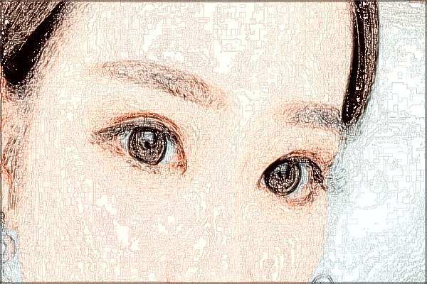 珠海市人民医院做近视眼手术怎么挂号?近视眼手术费用多少