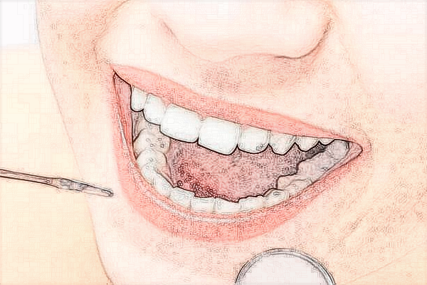 2024海口市人民医院正畸费用?牙齿矫正有必要吗?