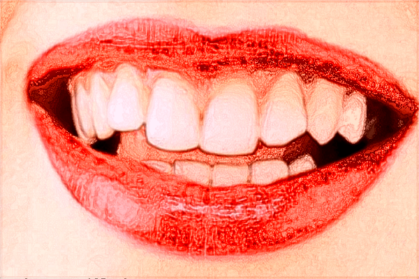 佛山市第二人民医院洗牙怎么样?洗牙多久洗一次好