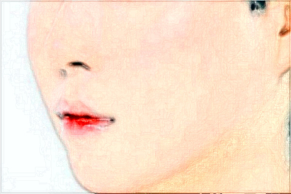 2024大庆市人民医院面部提升怎么样?全新案例分享