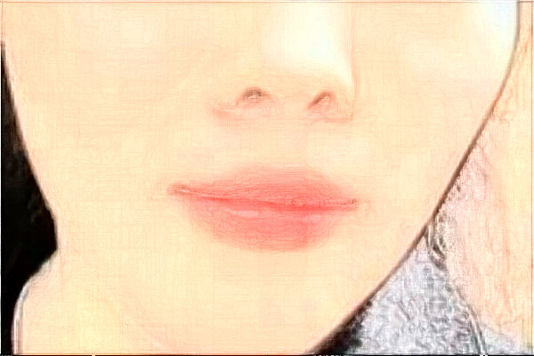 2024大庆市人民医院面部提升怎么样?全新案例分享