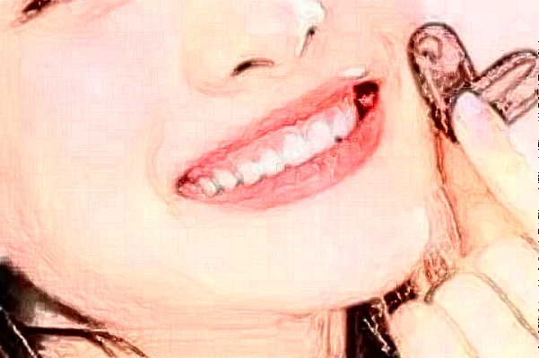 2024大庆市人民医院口腔科根管做的好吗?整形日记分享