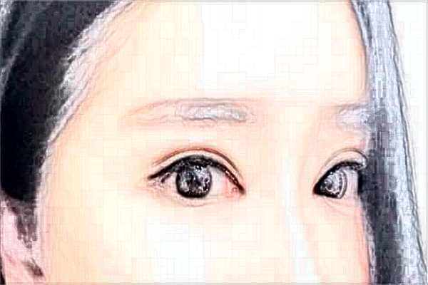 2024南京中大医院割眼皮怎么样_医生名单推荐