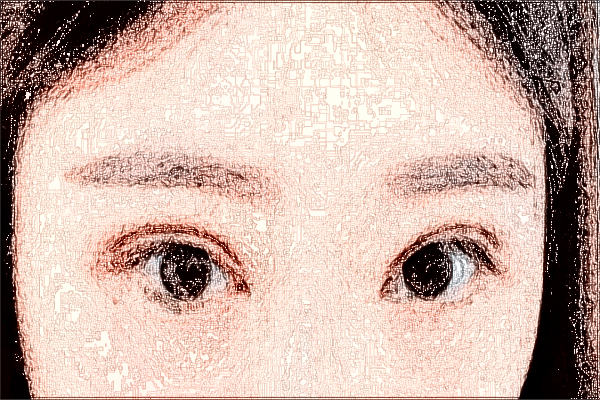 常德市第一人民医院近视手术怎么样?2024飞秒手术价格贵吗