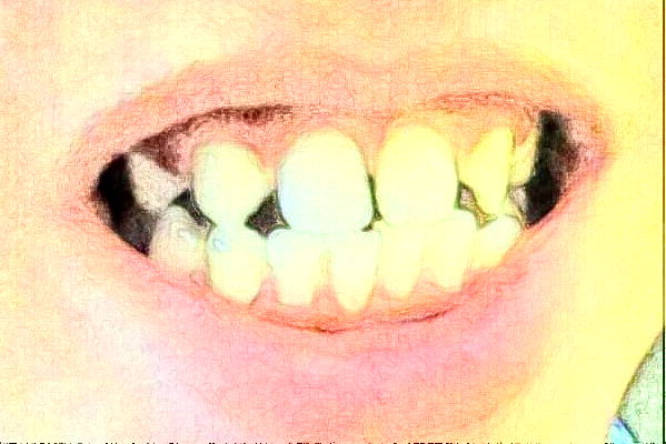 温州医学院附属第二医院口腔科种植牙做的怎么样_谁做的比较好