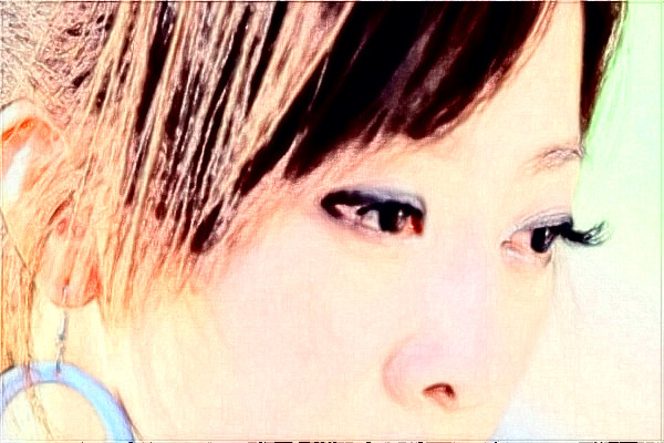 安徽省立医院祛斑做的好吗?整形日记分享