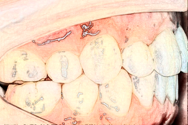 2024天津市儿童医院儿童口腔做的好吗?谁做得好