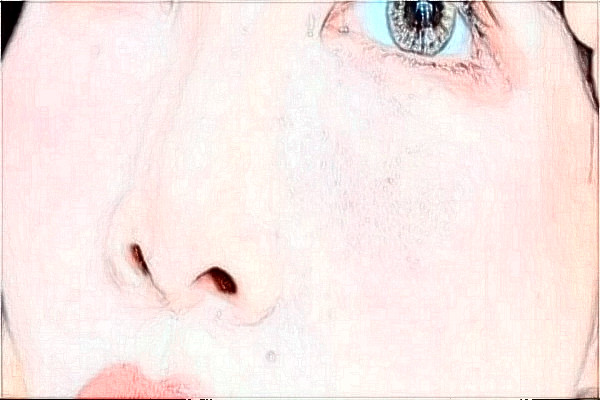 安徽省立医院热玛吉做的好吗?整形日记分享