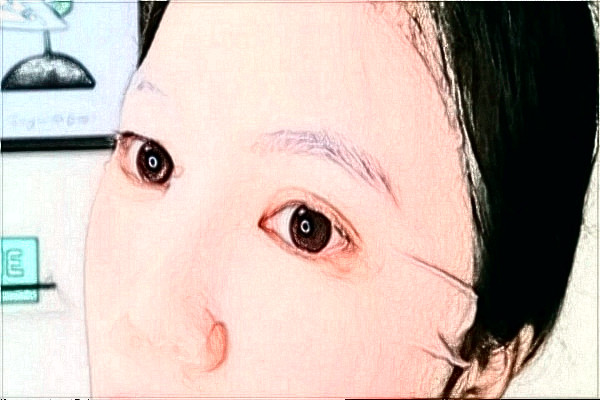 南通大学附属医院光子嫩肤多少钱?医生名单推荐