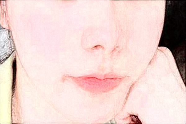 扬州市第一人民医院光子嫩肤怎么样?光子嫩肤案例分享