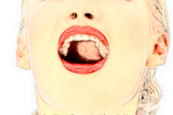 延边医院牙齿美白怎么样?全新案例分享