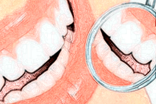 2024吉林大学第一医院口腔科根管怎么样_整形日记分享