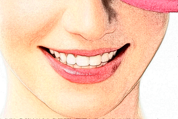 绵阳市中心医院牙齿贴面做的好不好?全过程分享