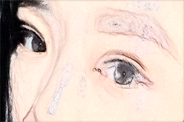 2024海口市人民医院近视激光手术费用?近视手术需要多久