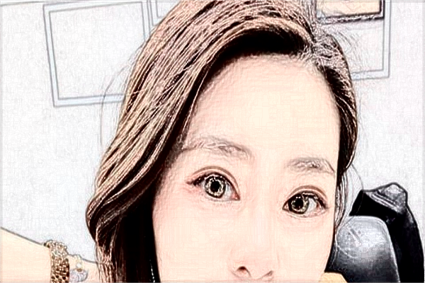 海口市人民医院医美怎么样?医美项目都有哪些