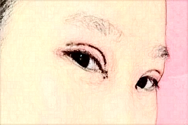 2024安徽省立医院开眼角怎么样_谁做得好