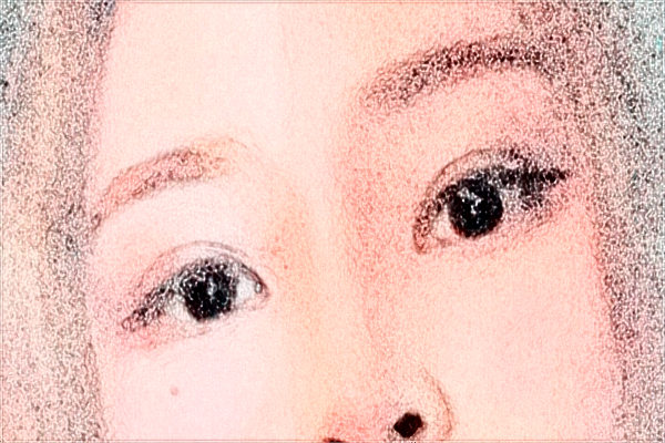 2024安徽省立医院开眼角怎么样_谁做得好