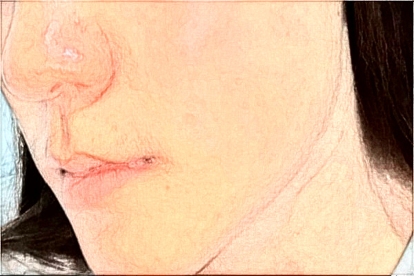 2024杭州市第一人民医院热玛吉怎么样_谁做得好