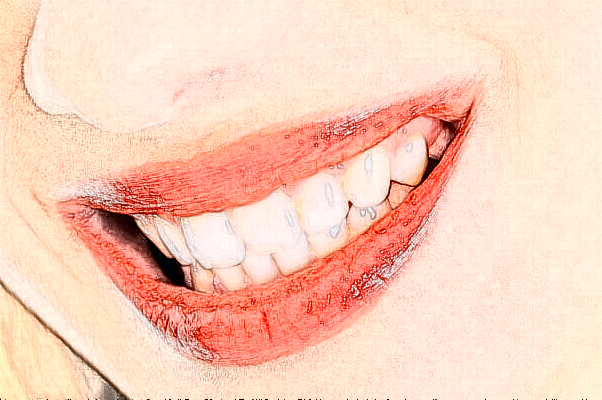 成都圣贝牙科医院种植牙好的医生推荐_美容日记展示