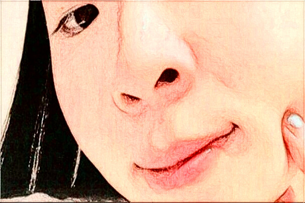 2024安徽省立医院去胎记做的好吗【去胎记案例反馈】