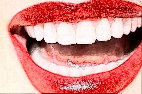 2024徐州医科大学附属医院烤瓷牙多少钱_医生名单推荐